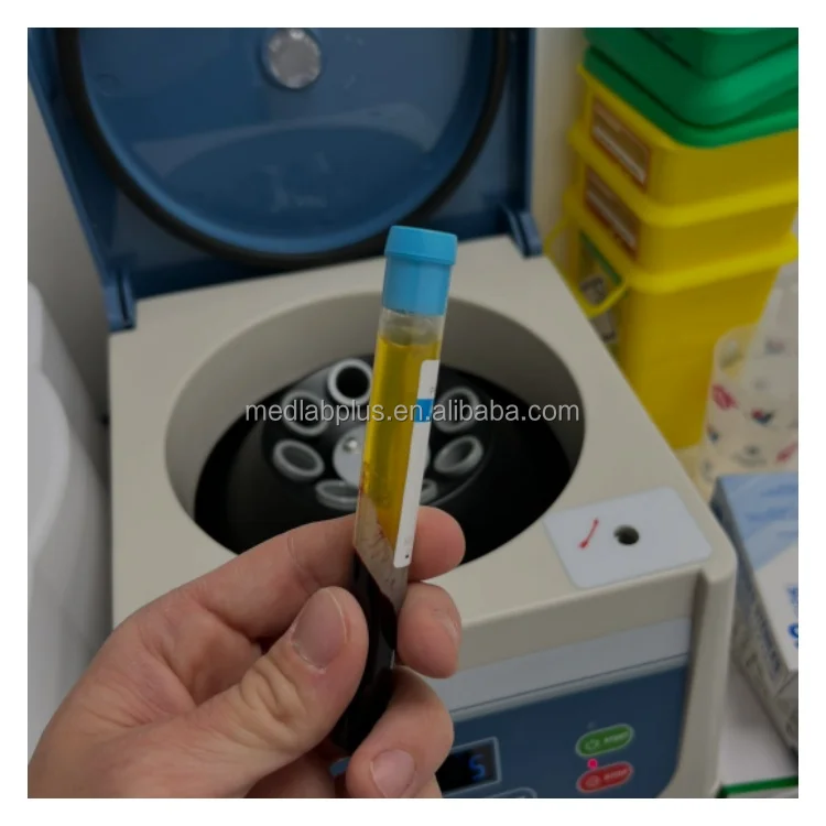 plasma gel centrifuge for prp platelet rich plasma centrifuge prp  blood spinning machine