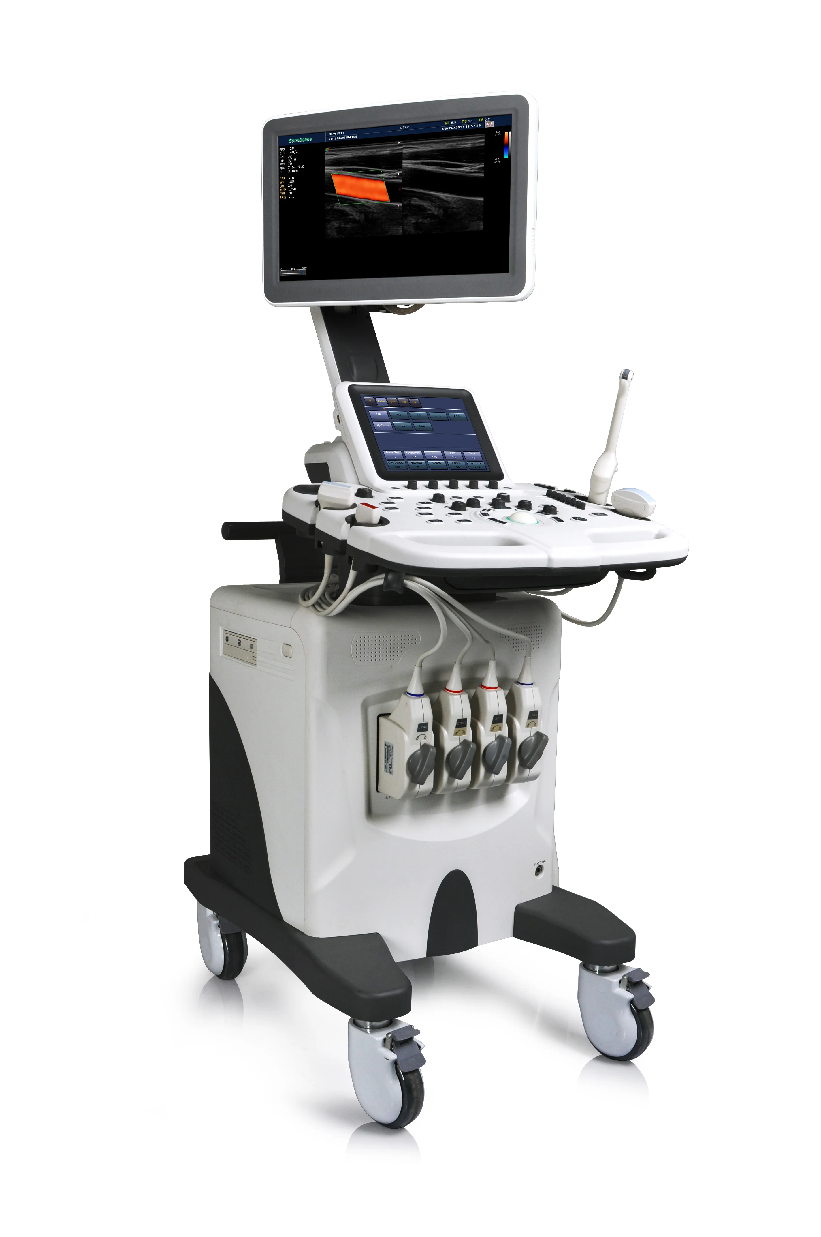 Best Price for Trolley Color Doppler 3D/4D SonoScape S30 with advanced technology