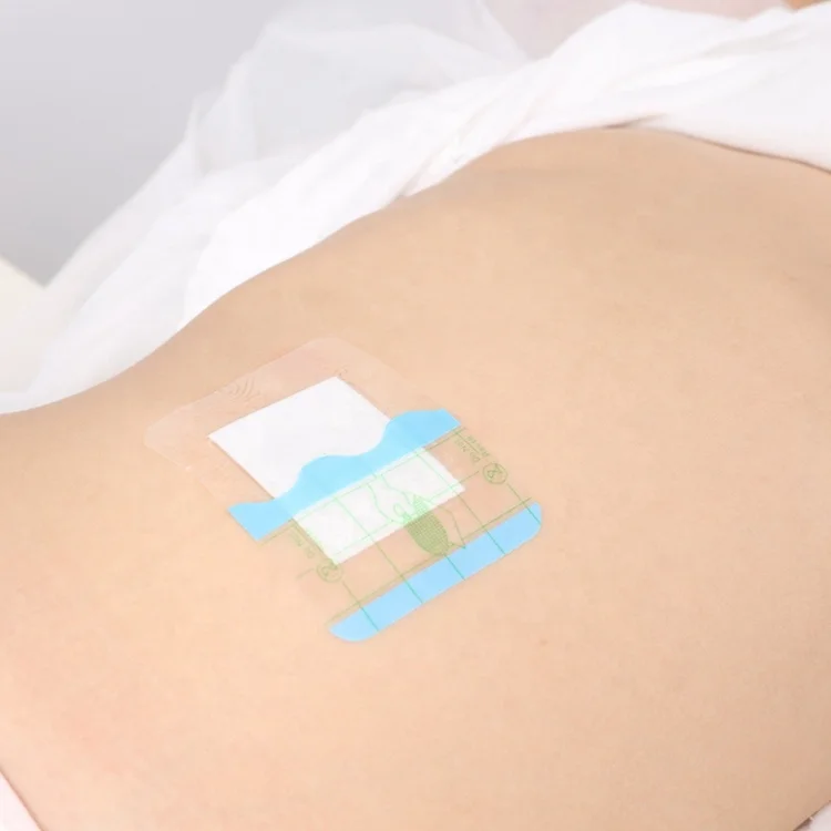 Hot sale medical transparent disposable wound umbilical film dressing for baby navel