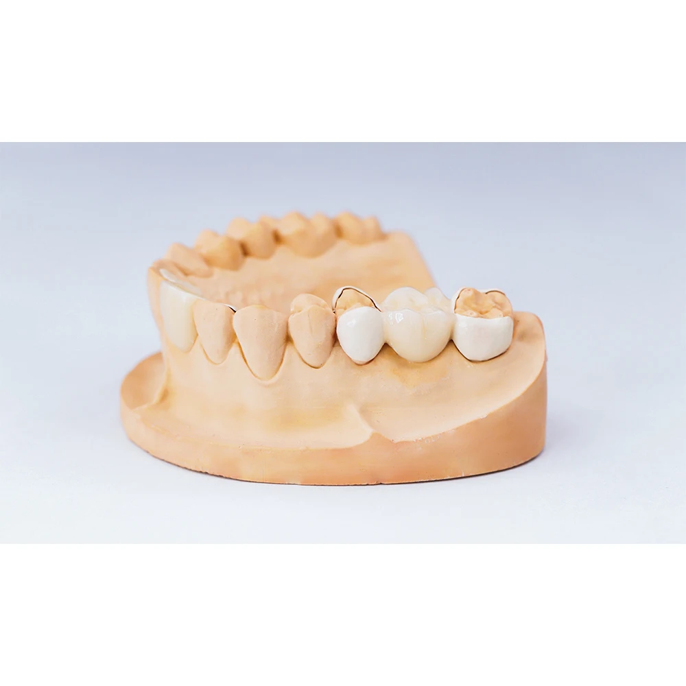 dental laboratory denture teeth fixed crown artificial tooth PEEK Composite Crown for dental clinic