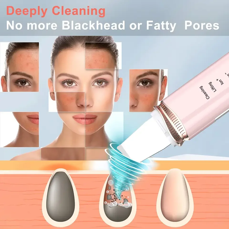 Comedones Extractor Deep Cleansing Skin Spatula Pore Cleaner Ultrasonic Ionic Skin Scrubber