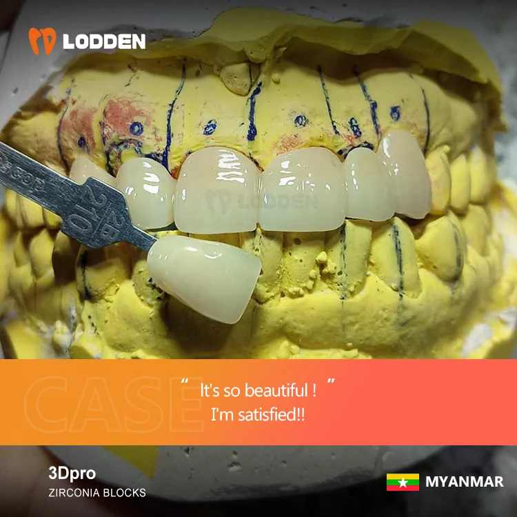 Dental lab CADCAM block zirconia blank discs 98mm 95mm AG multilayer LODDEN 3Dpro multilayer zirconia block