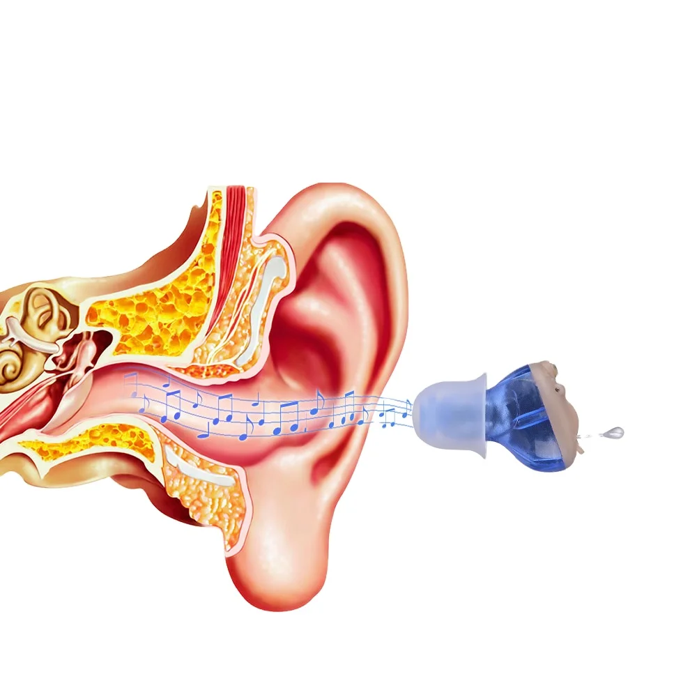 Multi-Channel Micro Cic Rechargeable Ite Hearing Aids Digital Hearing Aids For Severe Hearing Loss