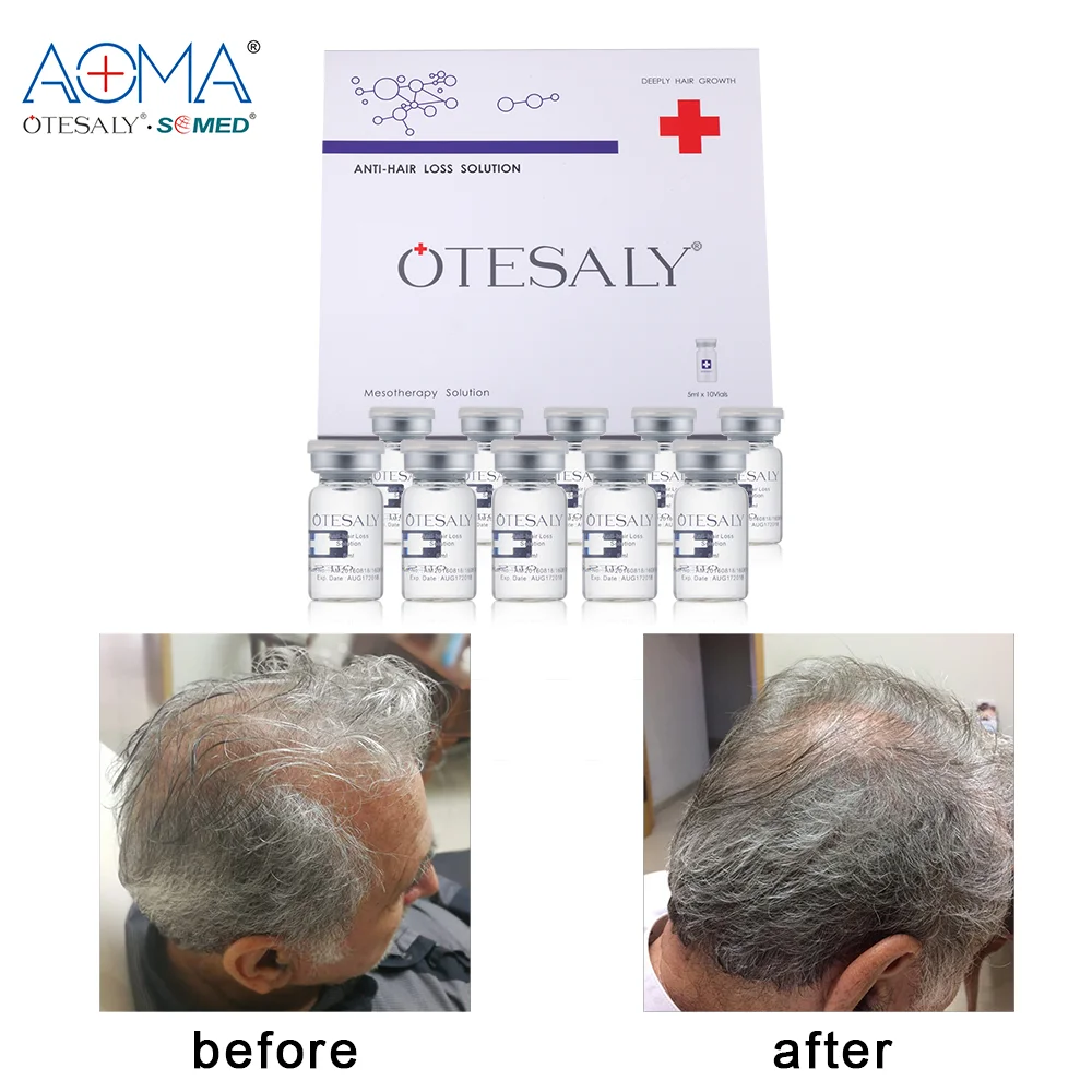 
Factory Direct Otesaly Scalp Injections Anti-hair Loss Mesotherapy Ampoules for Thinning Hair Mediterranean Hair 
