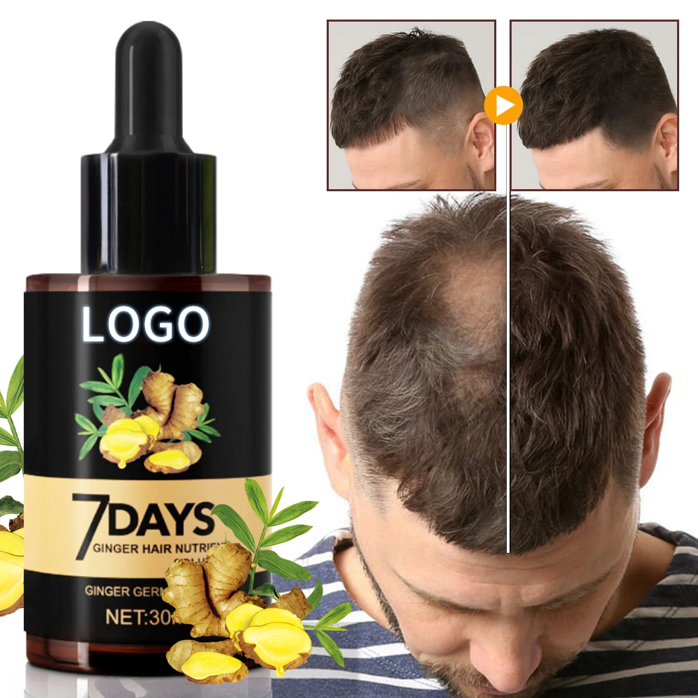 
private label natural biotin fast treatment oil hair growth serum 