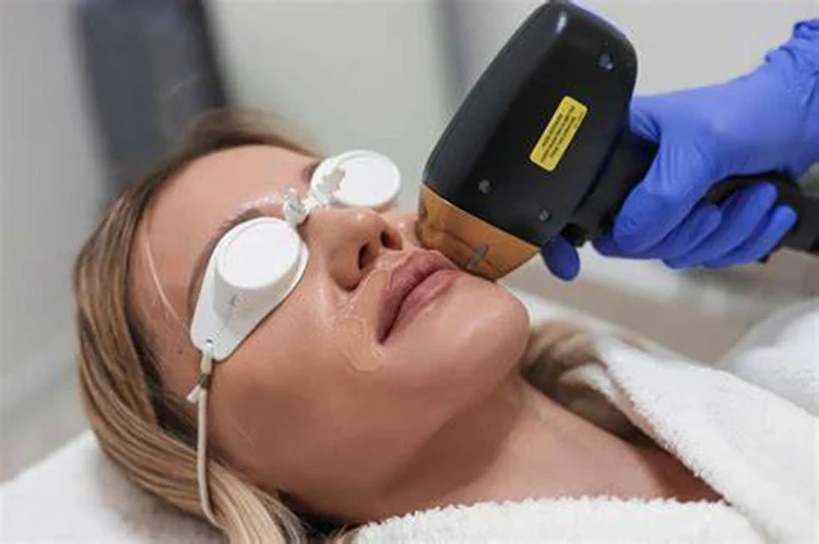 CE approved portable 808 diode laser hair removal machine price 755 808 1064nm diode laser hair removal machine