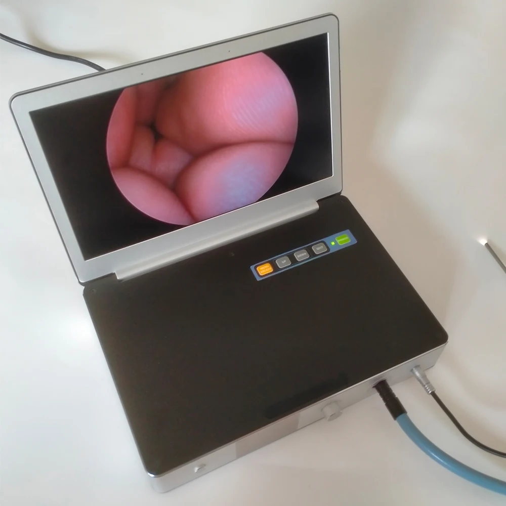 Camjoy full HD 1080p 11.6 laptop endoscope camera for orthopedics