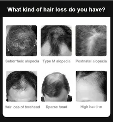 Bunee Thinning Hair Loss Treatment Liquid Solution Serum 60ml regrowth Oil