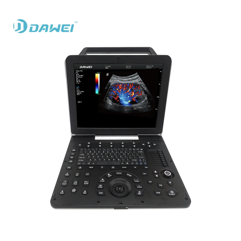 Portable cardiac ultrasound scanner color doppler ultrasound machine