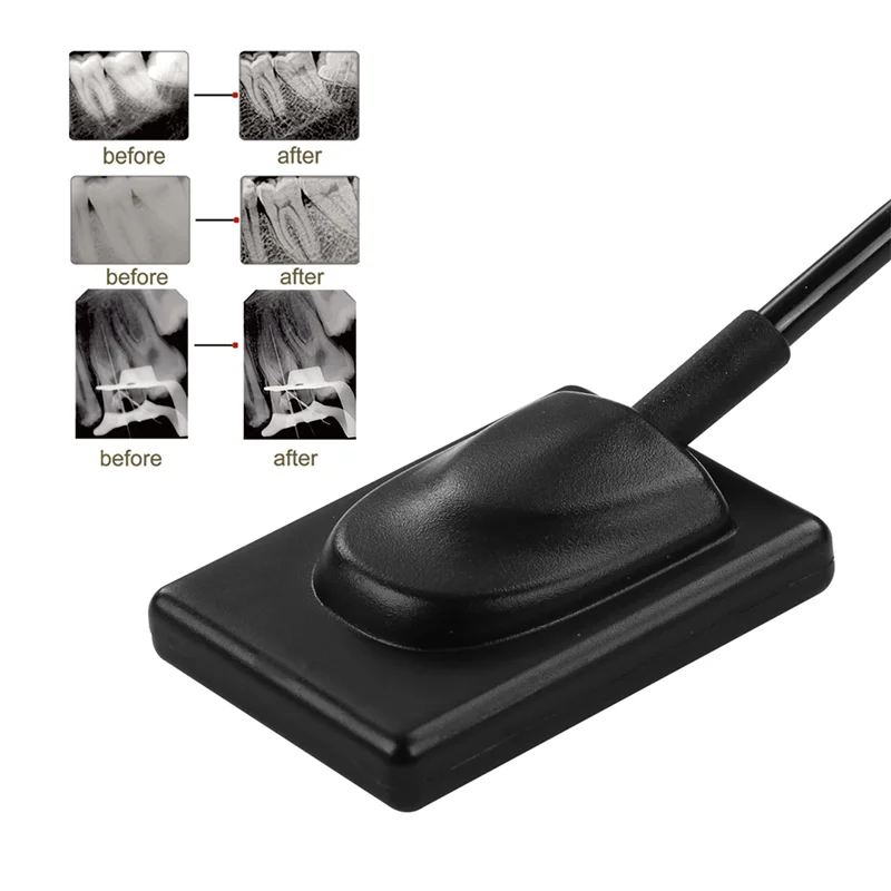 LK-C62 ветеринарная радиография с цифровой визуализацией рентгеновских зубных датчиков RVG