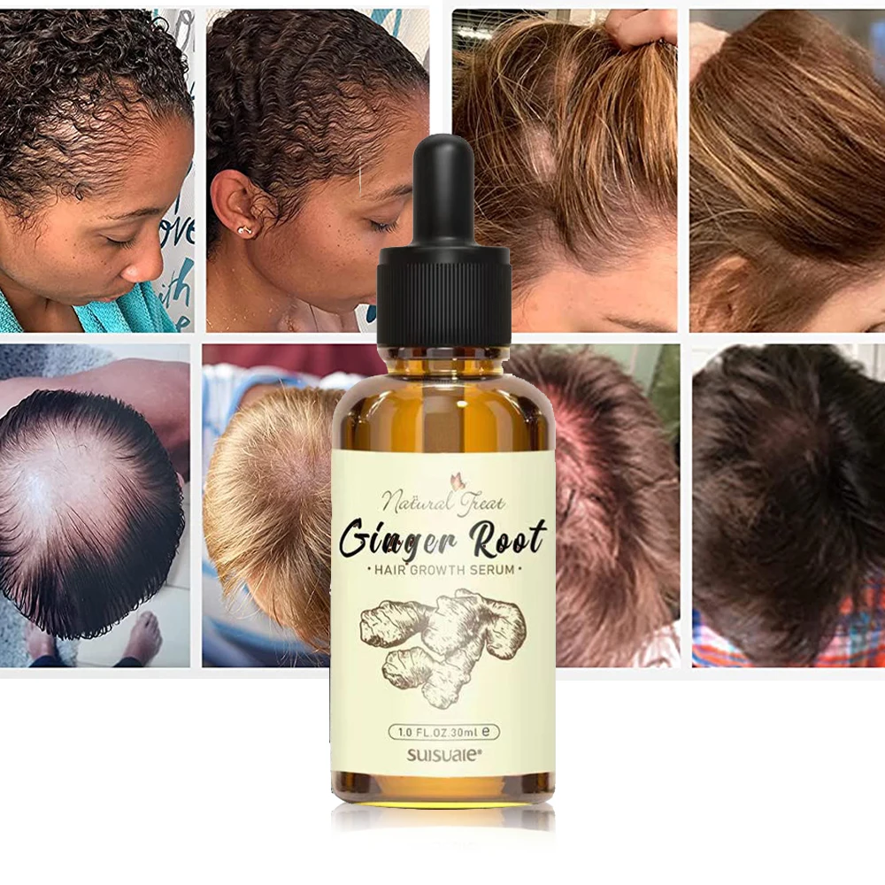 50 Moq Custom Private Label Best Black Women Natural Organic Herbal Ginger Hair Growth Oil Serum For Men Woman