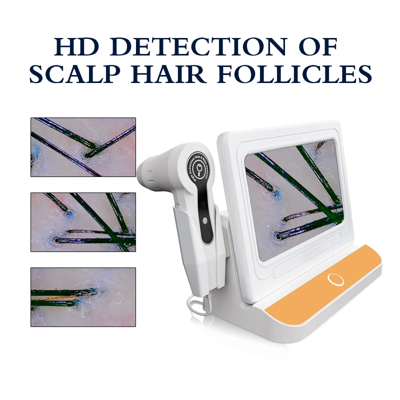 Hair salon dedicated HD hair skin detector all-in-one scalp scanner