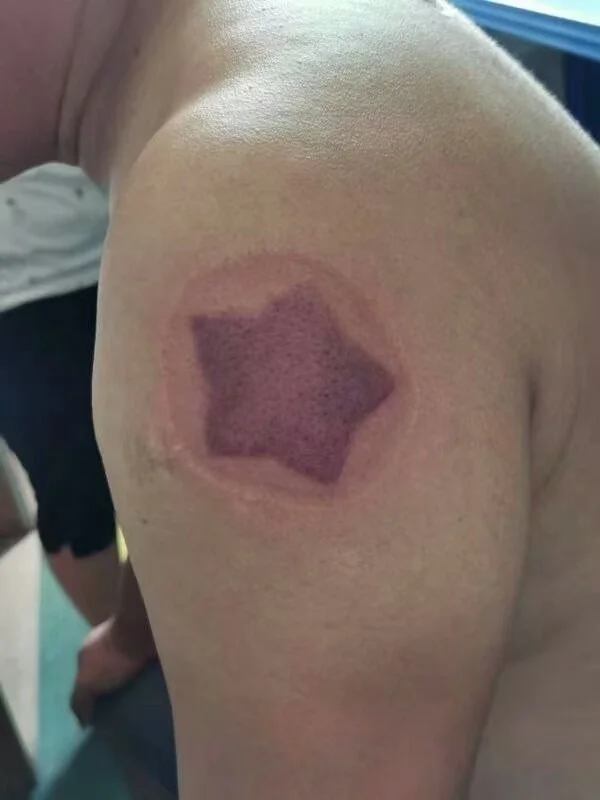 Special heart & star shape Massage therapy Device Acupuncture Suction Cups jar Vacuum Cupping