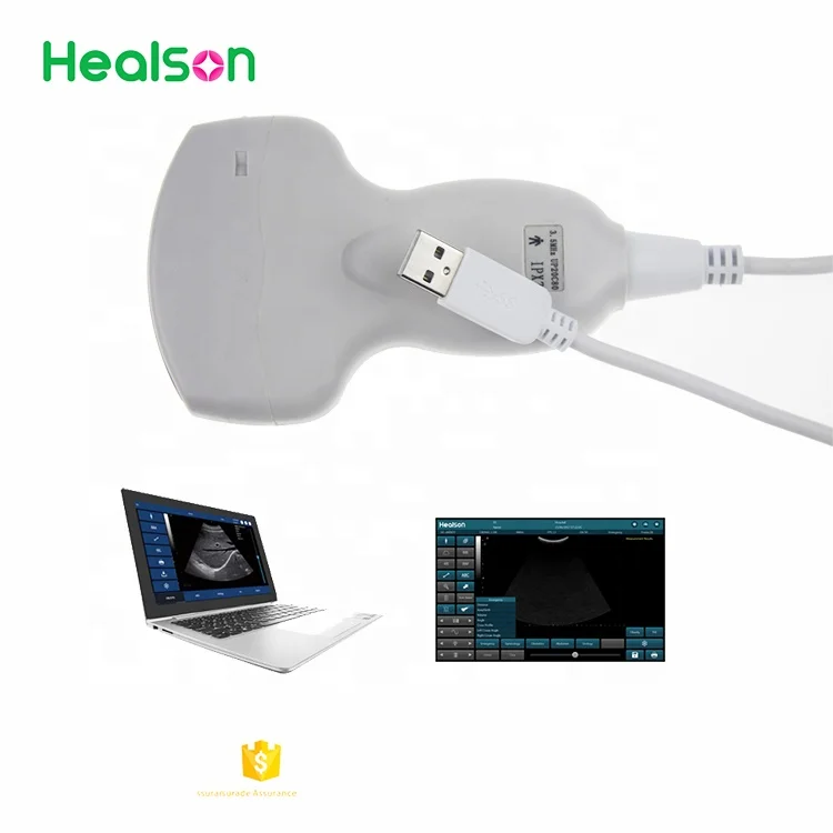 
Healson UP20 cheapest USB portable ultrasound machine /usb ultrasound probe 