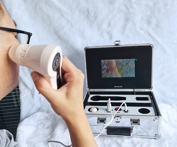 Portable skin and hair analyzer face scanner machine with screen