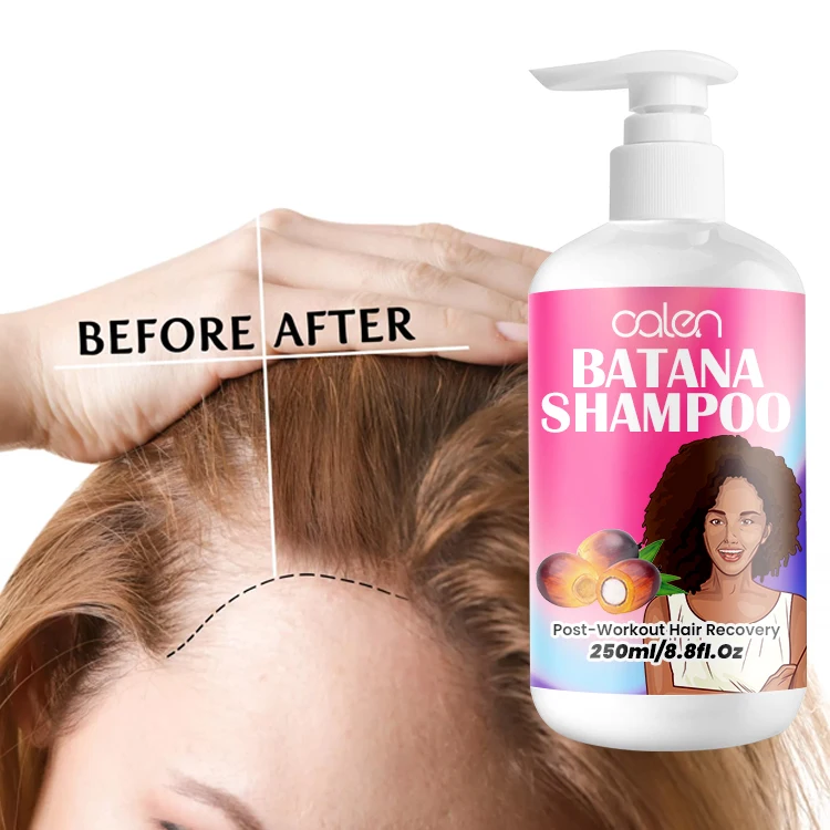 Luxfume 200Ml Customized Enhances Hair Shine Organic Batana Oil Hair Growth Shampoo