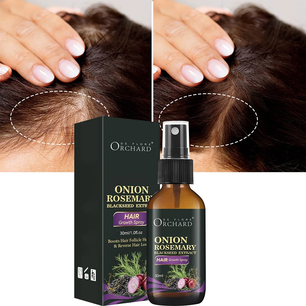 Free Sample Hair Onion Oil With Rosemary And Black Seed Oil Control Hair Loss Promotes Hair Growth Spray