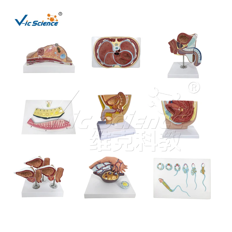 Natural Size Anatomical Model of Heart with Pathological Artery