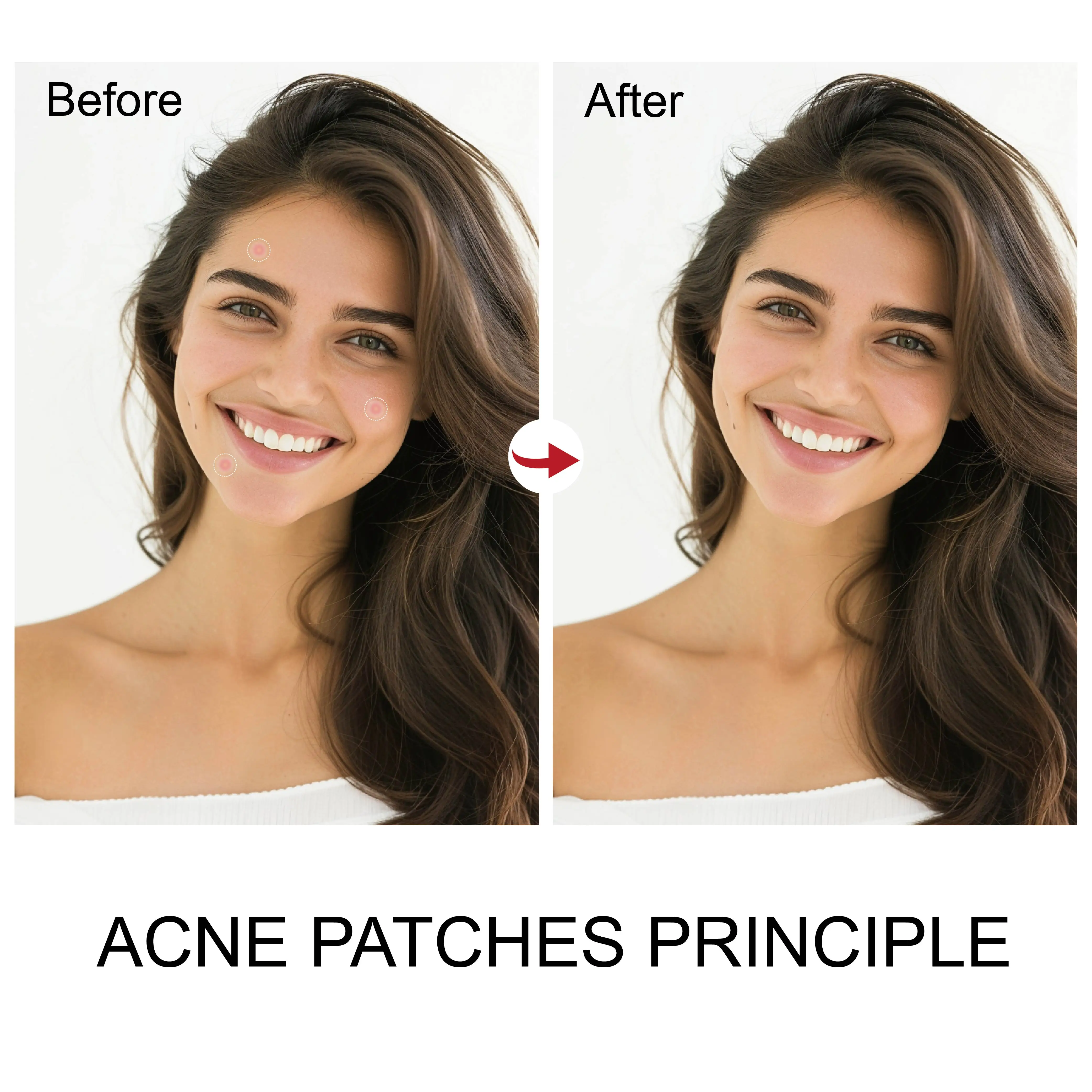 Skin care private label korea vegan acne patches invisible pimple patch with box