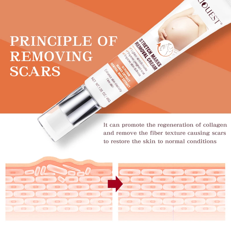 
Private Label Organic Herbal Acne Leg Deep Scar Removal Gel Anti Pregnancy Stretch Mark Removal Repair Cream 