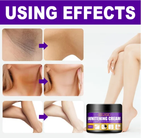 Высококачественный отбеливающий крем с темными коленями и локтями