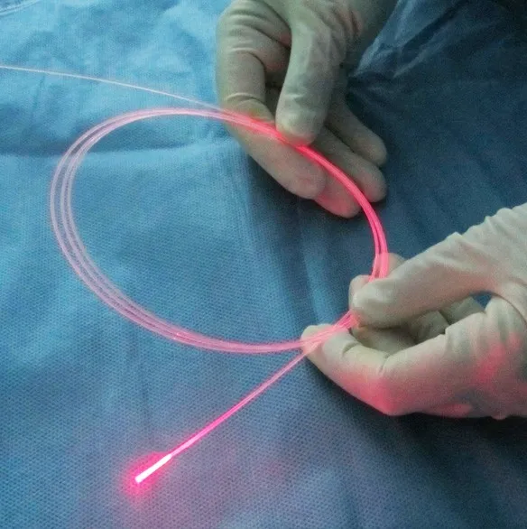 SMA905 Laser Treatment Radial Fiber 400um 600um 800um ENT Bare Fiber Varicose Veins Hemorrhoids PLDD Gynecologist Optical Fibers
