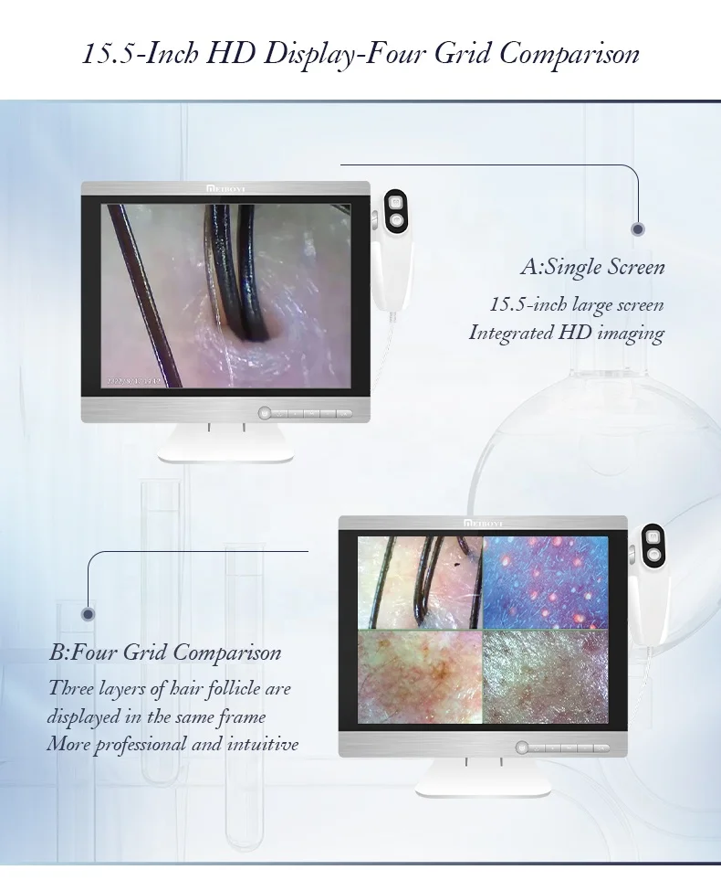 Meiboyi Portable 15.5 inch HD Hair follicle withered Skin Analysis Machine Scalp Camera Detector Beauty Equipment