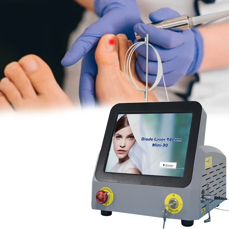 New Sale Class IV No Side Effects Non-Invasive Nail Fungus Treatment Laser Machine 980nm Diode Equipment