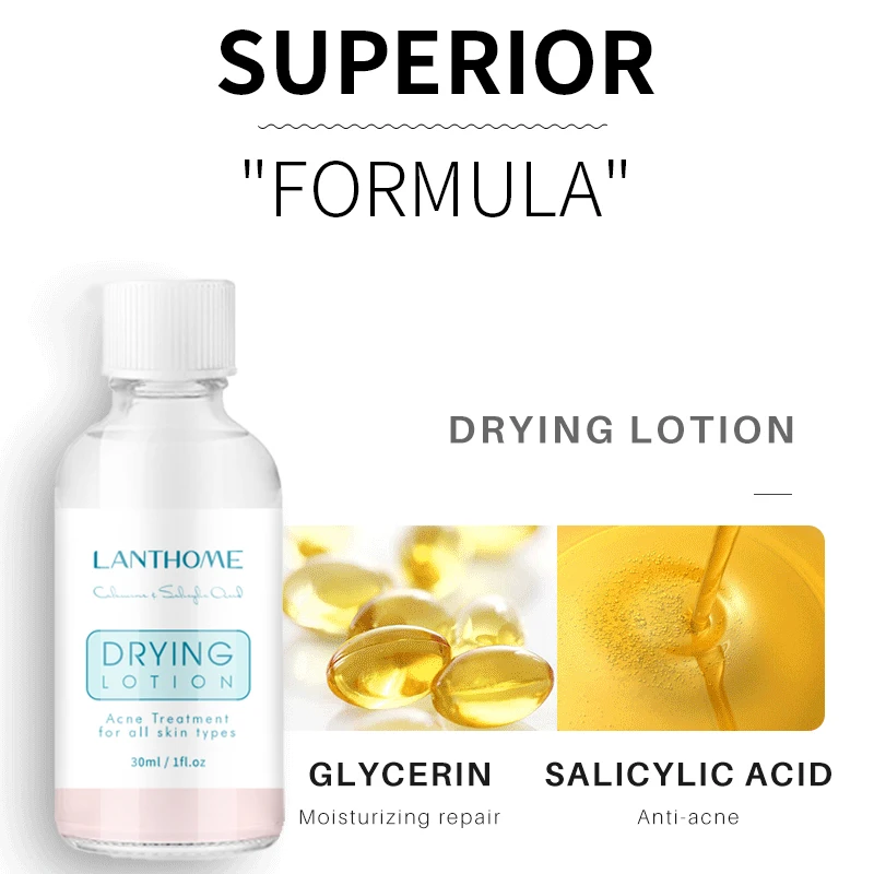 OEM Drying Lotion Acne Pimple Surface Blemish Removing Serum Dark Spot Remover Calamine Lotion