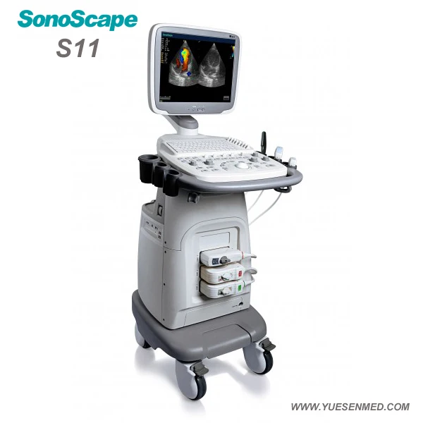 Хорошая цена медицинская тележка типа ультразвук S11 Sonocape 3D/4D Цветной Допплер ультразвуковой