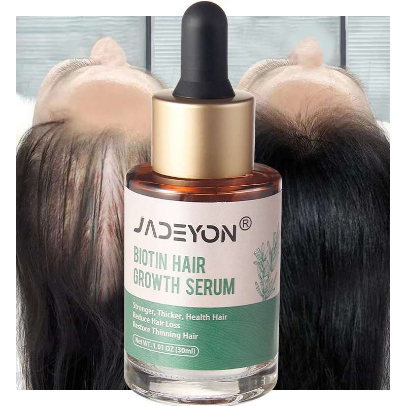 Сыворотка для кожи головы органическое масло розмарина сглаживание частная торговая марка сыворотка выпадения волос биотин быстрое роста
