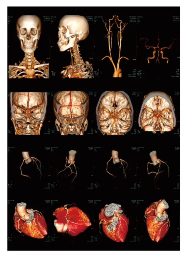 8x10 10x12 14x17 inch Medical dry X-ray Thermal film, blue PET polyester film for Agfa 5302 Fuji drypix 2000 3500 lite printers