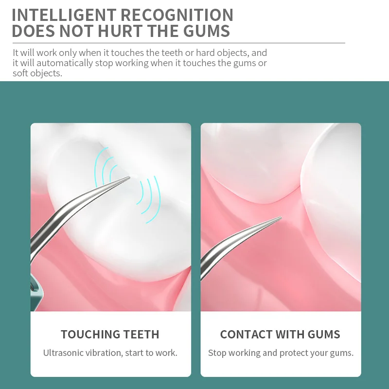 Hot sale Dental High-Frequency Visual Cleaning Teeth Painless Ultrasonic Visible Dental Scaler for Home Use