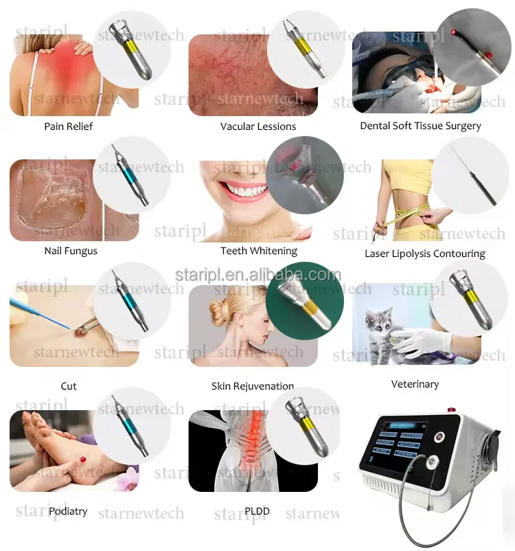 Tighten skin machine portable diode laser 980nm 1470nm face lifting endolaser 1470 laser liposuction for facial and body treat