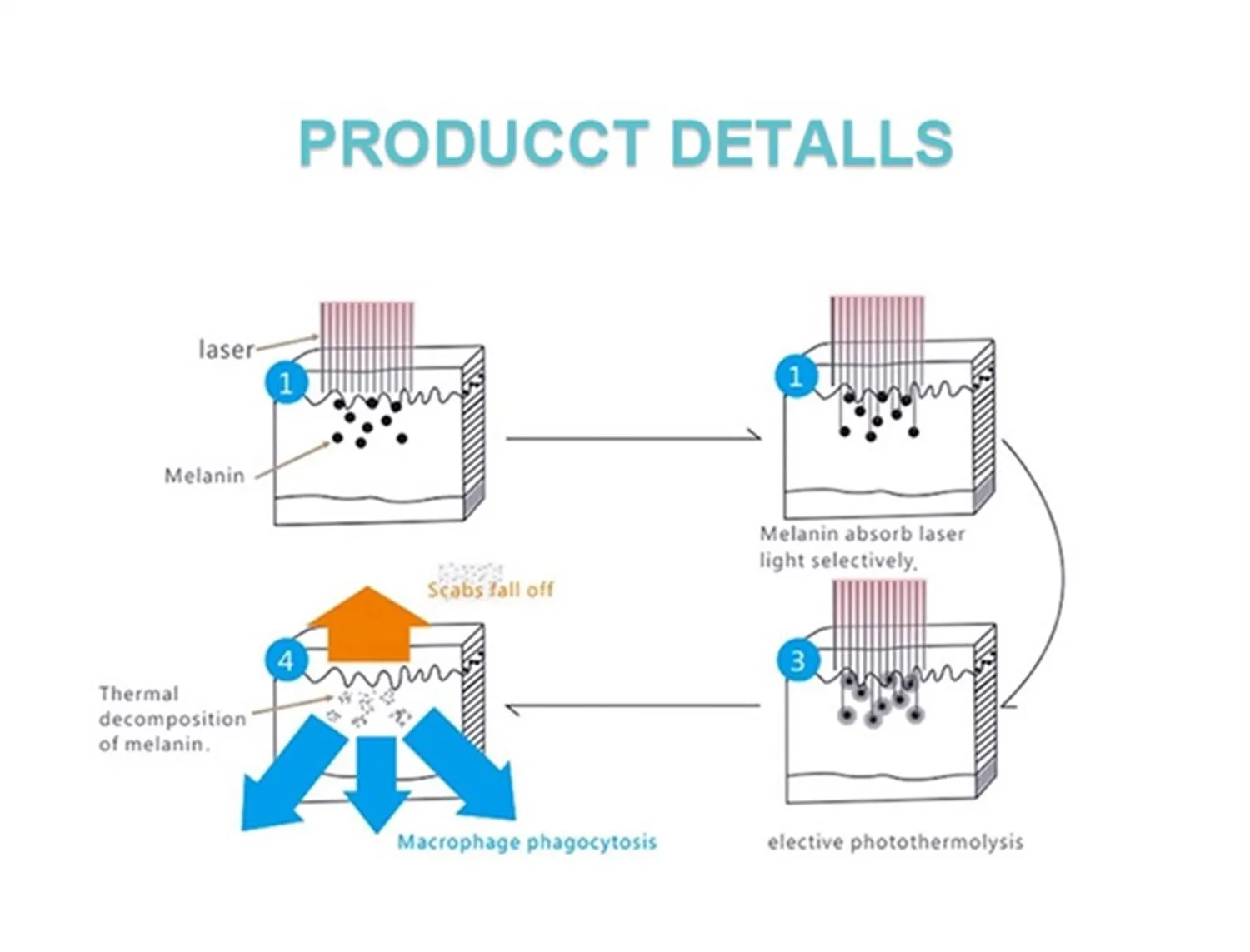Самая современная технология, лидер продаж, аппарат для красоты nd yag, мини-татуировка, Овальный лазер, заводская цена