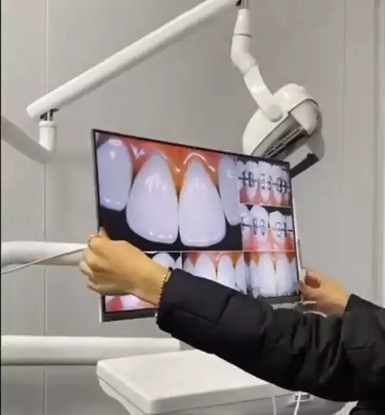 The most sold Computer HD Touch Screen Endoscopic Equipment Dental Wifi HD 1080P Intraoral Camera