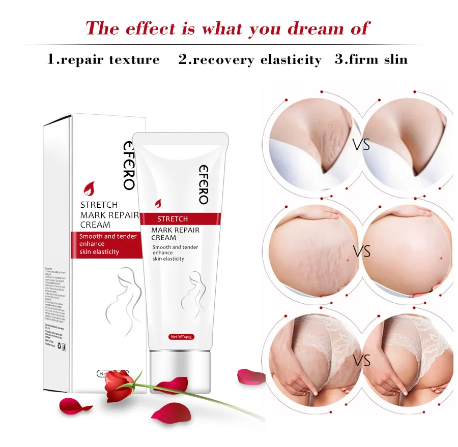 
Organic Natural Stretch Marks Remove Acne Scar Treatment Cream For Pregnancy Repairing Scars for Women Private label 