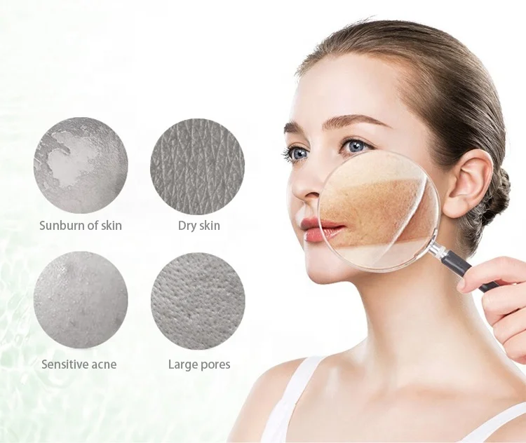 OEM Private Label 100% Pure Natural Organic Aloe Vera Smoothing Gel Moisture Repair Cream Face Acne Treatment Gel Aloe Vera Gel