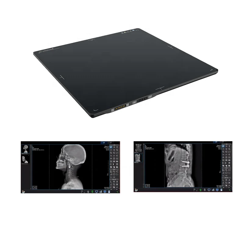 Newest Dr Flat Panel Detector X-ray Flat Panel Digital Detector Wireless