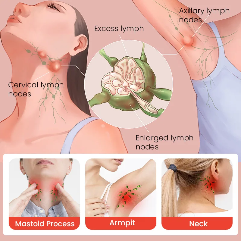 Herbal Lymphatic Drainage Cream Anti-Swelling Lymph Node Treatment Breast Ointment Lymphatic Ointment