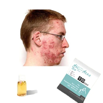 Wholesale Natural Anti-acne Tea  Dried Rose Flower Tea Flavor Tea