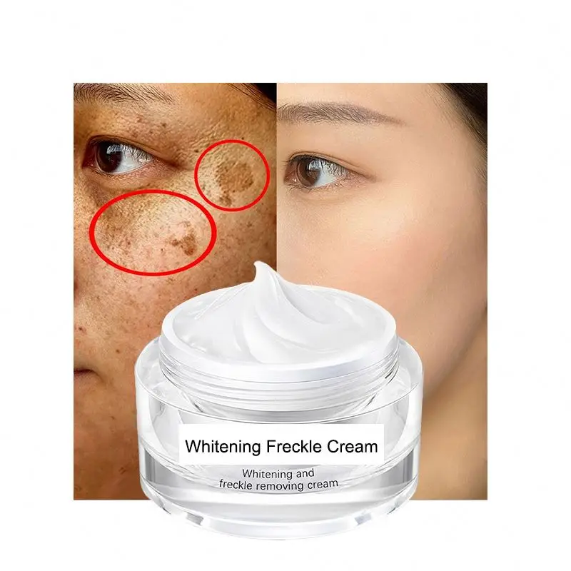 Bulk buy stuff face products skin care korean dark spot corrector set cream whitening