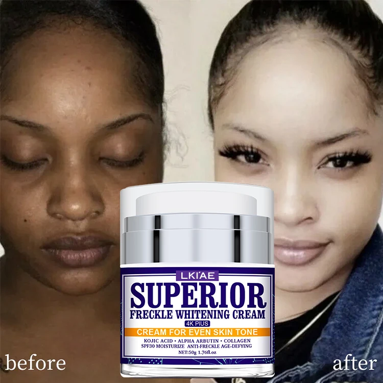 Private Label Skin Powerful Whitening Freckle Removal Face Bleaching Cream