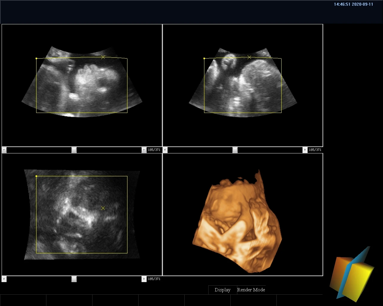 Veterinary 4D Diagnostic Full Digital Color Ultrasound Scanner Ultrasound Equipment