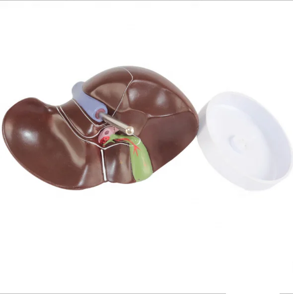 Medical Supplies Human Teaching Liver Pathological Model For School Medical Teaching Display Tool Lab Equipment