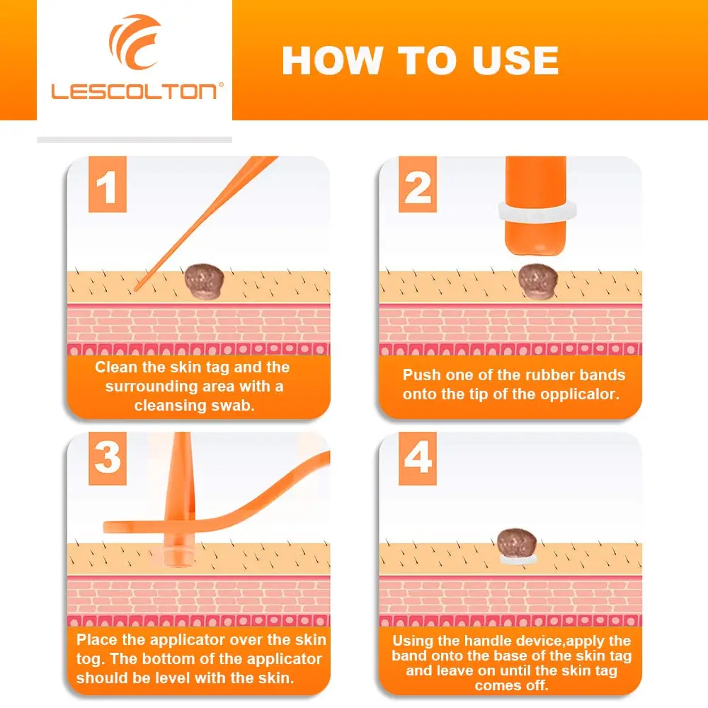 Orange Set Skin Tags Removal Kit Home Use Mole Wart Remover Equipment Micro Skin Tag Treatment Tool Easy To Clean Skin Care Tool