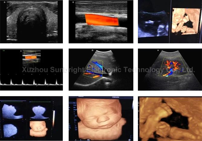 CE 4D one stop whole body diagnosis best image quality color Doppler ultrasound PW CW ultrasound baby