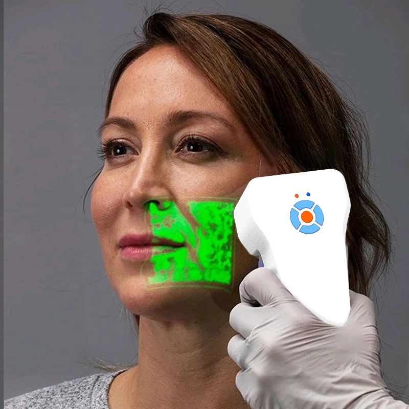 
Vein finder detects veins by infrared technology displaying vein map directly on skin 