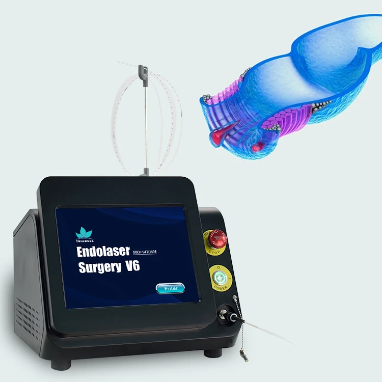 Triangel 980 1470 Diode Laser For Proctology Internal External Mixed Hemorrhoids Treatment Laser Machine