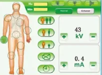 PLX7000A Medical Machine Orthopedic 100mA X-Ray Machine  C-arm